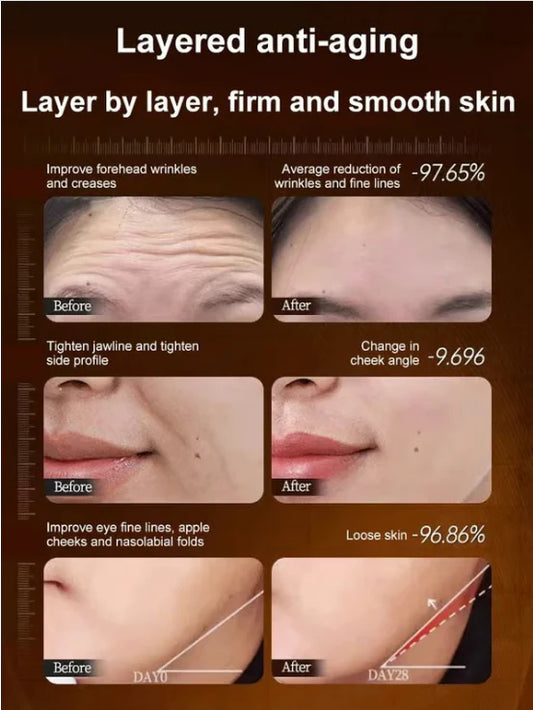 🔥BUY 1 GET 1 FREE🔥Micro-molecular collagen anti-wrinkle lotion