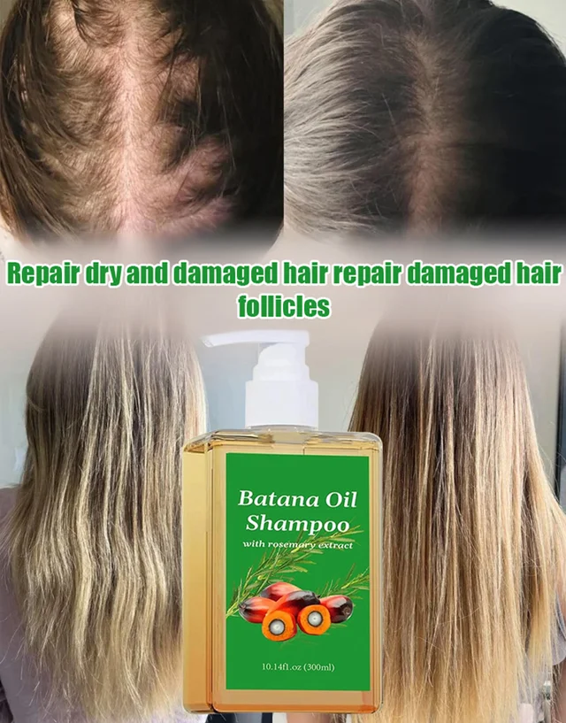 Hair growth shampoo