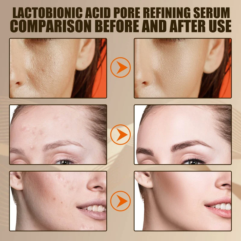 Lactobionic acid pore contraction Face Serum