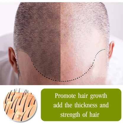 💥BIG DISCOUNT TODAY - 2024 NEW Hair growth essential oil