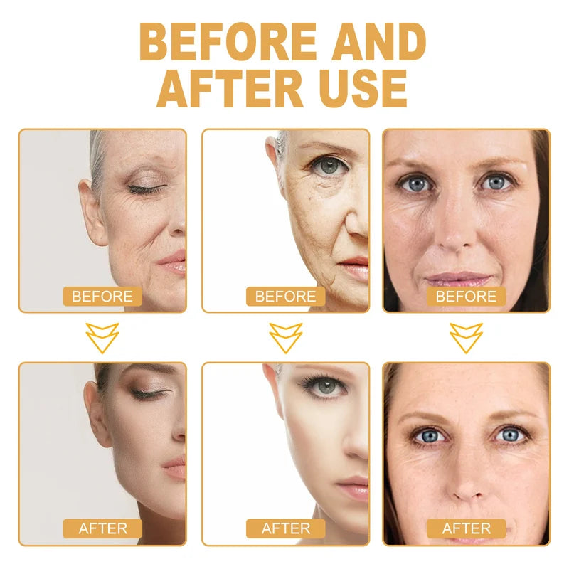 🎁HOT SALE🎁-Korea Small Molecule Collagen Anti-Aging Spot Correction Essence