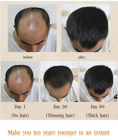 💥BIG DISCOUNT TODAY - 2024 NEW Hair growth essential oil