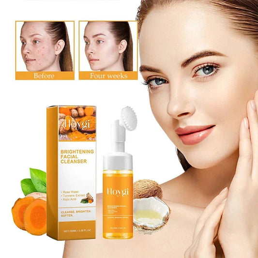TURMERIC FACIAL CLEANSER FOR ACNE SCARS & MARKS - DEEP CLEANSING & BRIGHTENING