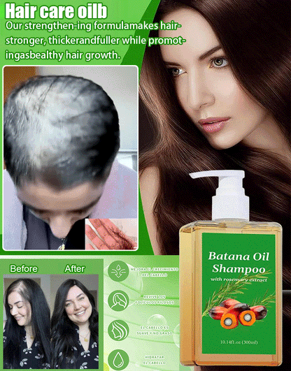 Hair growth shampoo