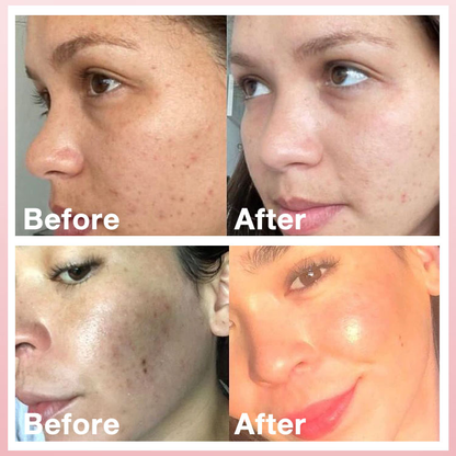 Whitening Cream-Gently fades peels dark spots to revealmore even &brighter skin