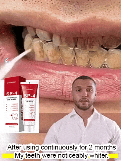 💥2024 Experts Recommend Product-Fresh Whitening Probiotic Toothpaste