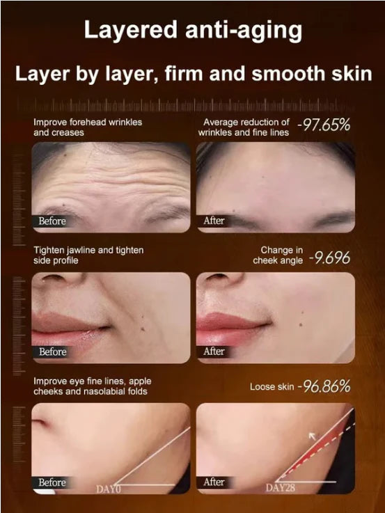 🔥BUY 1 GET 1 FREE🔥Micro-molecular collagen anti-wrinkle lotion