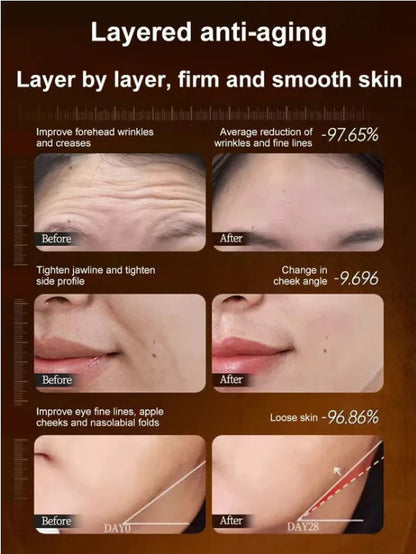 🔥BUY 1 GET 1 FREE🔥Micro-molecular collagen anti-wrinkle lotion