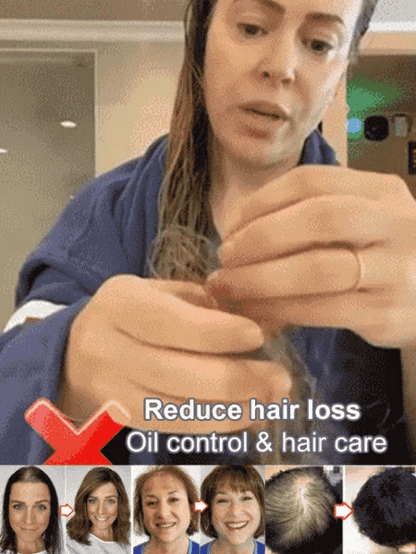 ✨Last Day Promotion🎁Hot Sale Ginger Plant Extract Anti-Hair Loss Hair Shampoo