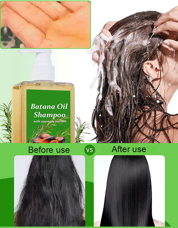 Hair growth shampoo