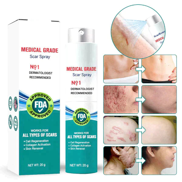 ⚡️LOVILDS™ Advanced Scar Spray For All Types of Scars - For example Acne Scars, Surgical Scars and Stretch Marks