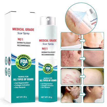 ⚡️LOVILDS™ Advanced Scar Spray For All Types of Scars - For example Acne Scars, Surgical Scars and Stretch Marks