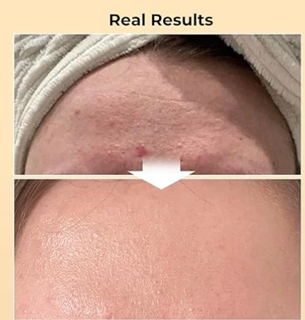 Korean Snail Mucin Facial Essence