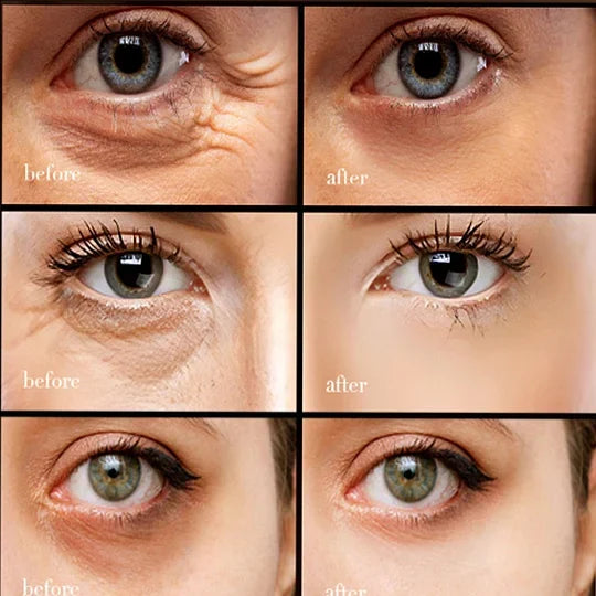 💥10000+ people feel effective🔥2024 NEW Retinol Caffeine Anti-Wrinkle Stay-Up Late Eye Cream