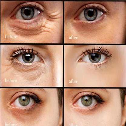 💥10000+ people feel effective🔥2024 NEW Retinol Caffeine Anti-Wrinkle Stay-Up Late Eye Cream