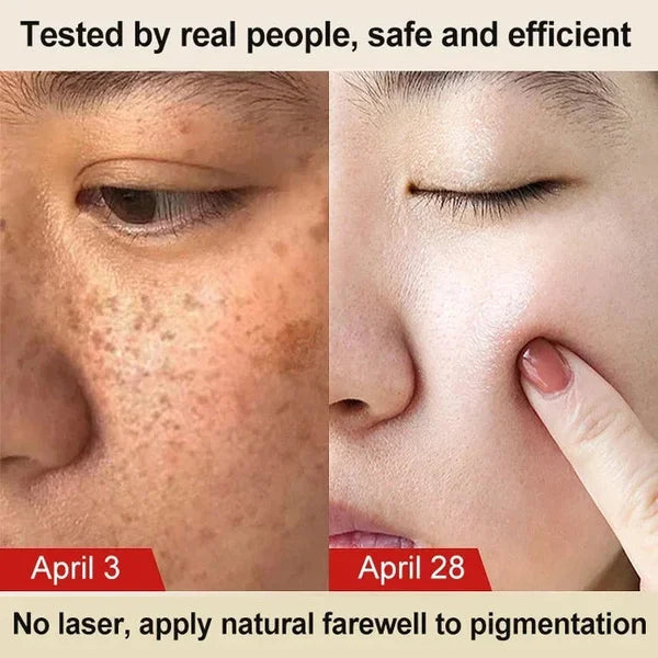 🔥LAST DAY 51% OFF🔥HERBAL ASTRAGALUS CREAM