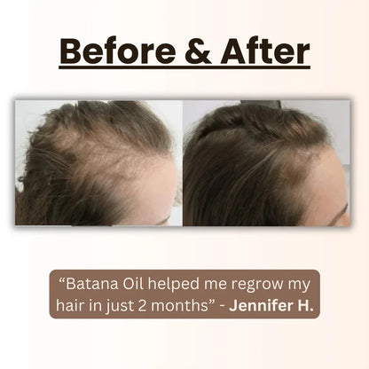 Limited Time Discount-Natural Handcrafted Batana Oil Hair Growth Blend 4.2OZ