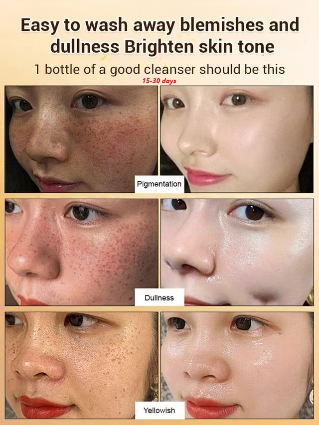 Upgraded anti-freckle essence oil