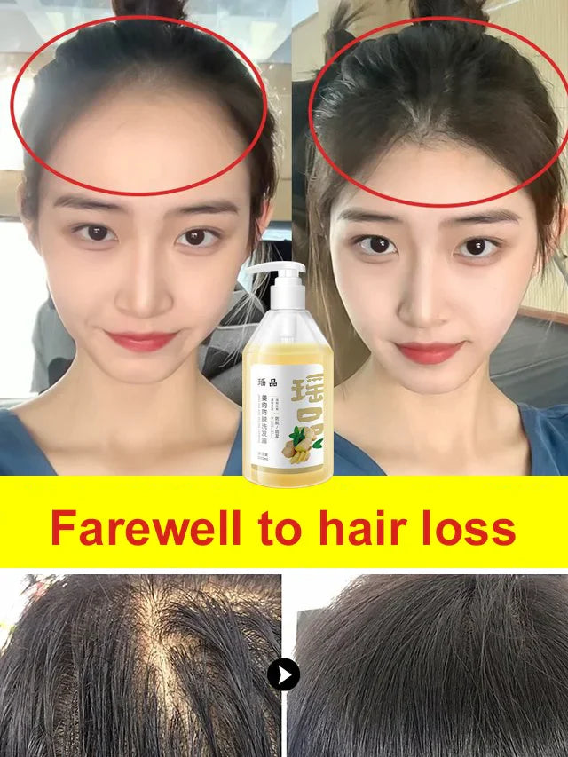 Smooth And oil Control Anti Hair Loss Shampoo