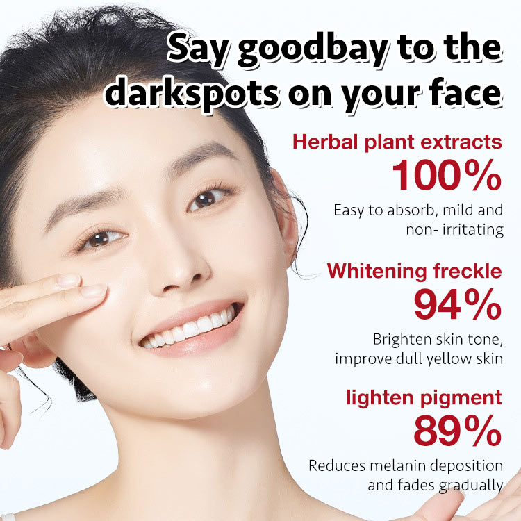 Whitening Cream-Gently fades peels dark spots to revealmore even &brighter skin