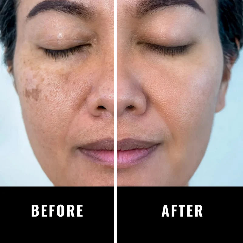 💥HOT SALE💥-2024 New Turmeric Cleansing Pads