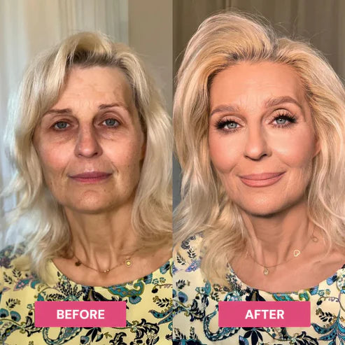 ✨LAST DAY BUY 1 GET 1 FREE✨REVIVE TIRED EYES -HYDRATING & ANTI-WRINKLE EYE BALM