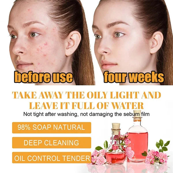 TURMERIC FACIAL CLEANSER FOR ACNE SCARS & MARKS - DEEP CLEANSING & BRIGHTENING