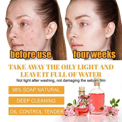 TURMERIC FACIAL CLEANSER FOR ACNE SCARS & MARKS - DEEP CLEANSING & BRIGHTENING