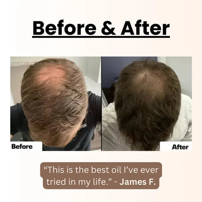 Limited Time Discount-Natural Handcrafted Batana Oil Hair Growth Blend 4.2OZ