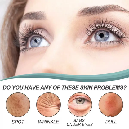 Dark Spot Corrector-Special Cream For Melasma Treatment