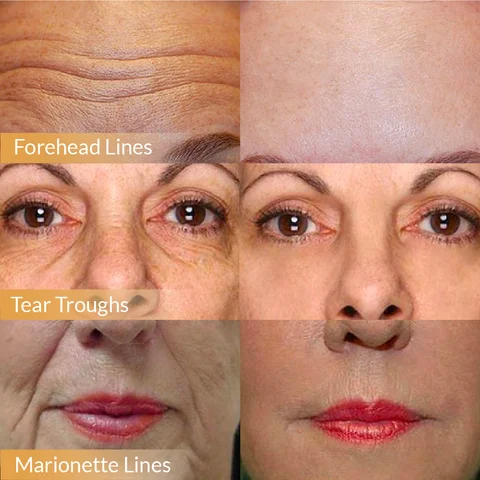 🎁2025 Hot Sale🎁Polypeptide Firming Full Face Cream-CHANGE FOR BEAUTIFUL SKIN WITHIN 2 WEEKS