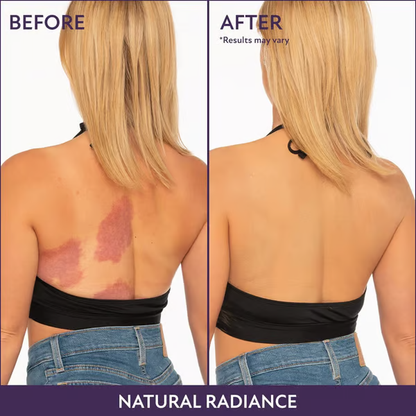 All Over Complexion Perfector