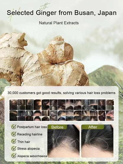 ✨Last Day Promotion🎁Hot Sale Ginger Plant Extract Anti-Hair Loss Hair Shampoo