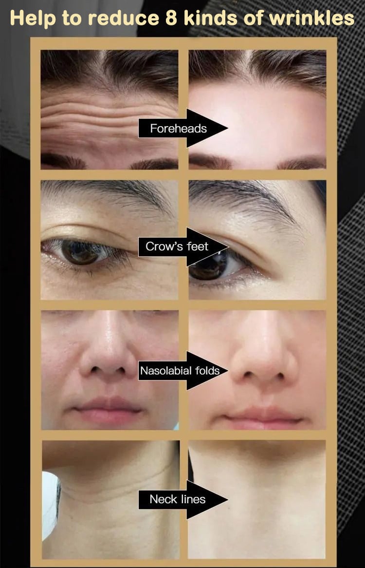 💥MOTHER'S DAY HOT SALE - 2024 THE MOST POPULAR ANTI WRINKLE FACE CREAM🔥BUY 1GET 1 FREE