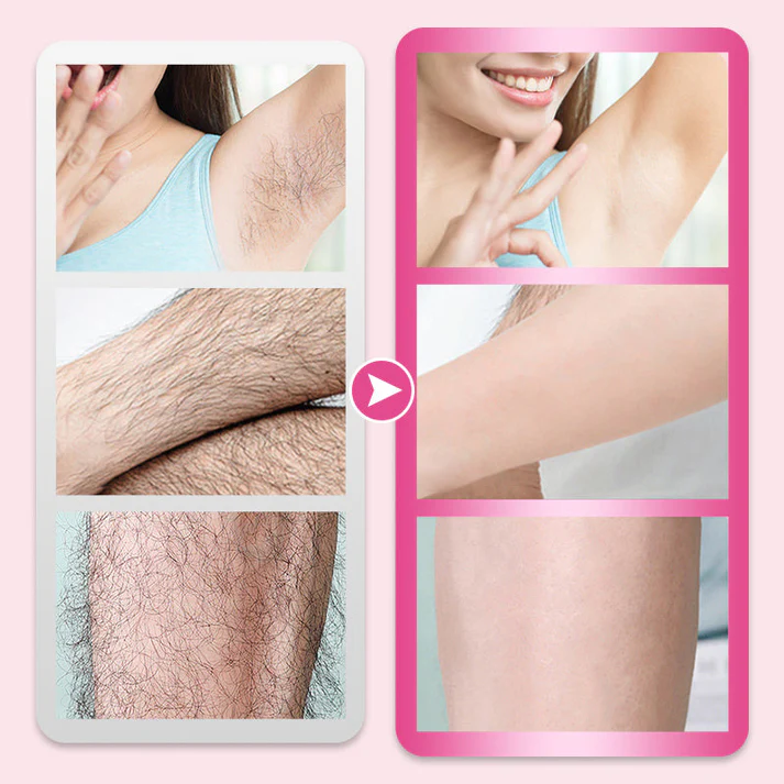 Flawless Gentle Hair Removal Cream