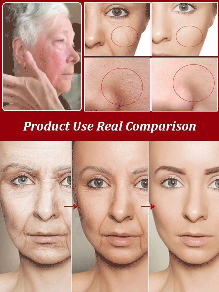 💥Daily Sales of 3000+🔥 2024 New Lifting and Firming Anti-Wrinkle Serum Capsules