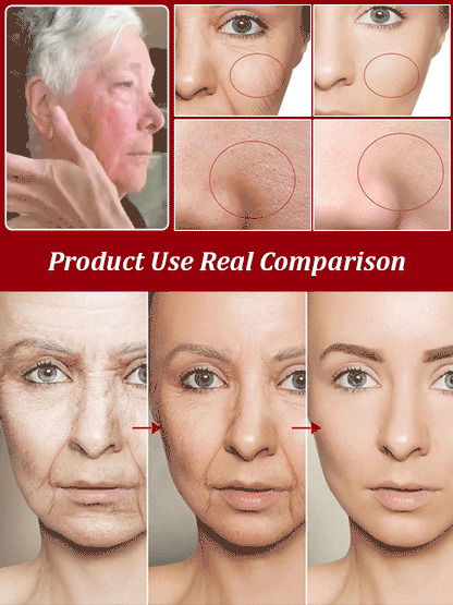 💥Daily Sales of 3000+🔥 2024 New Lifting and Firming Anti-Wrinkle Serum Capsules