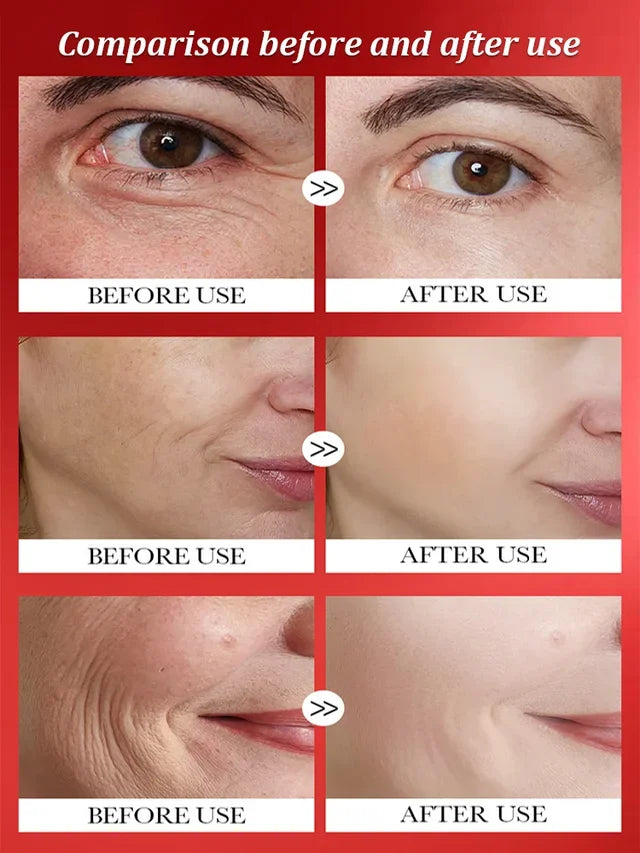 💥Daily Sales of 3000+🔥 2024 New Lifting and Firming Anti-Wrinkle Serum Capsules