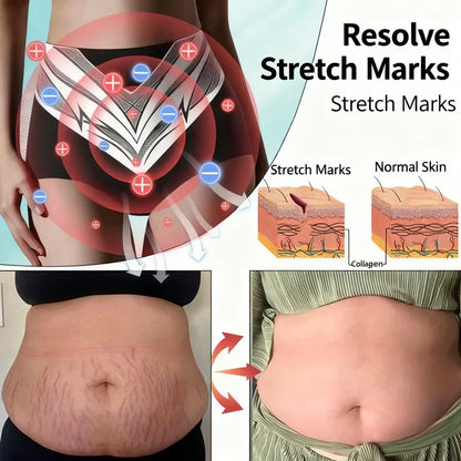 🎉 Limited-time offer – huge discount! 💰 Alisanda™ Self-regulating tourmaline shaping shorts with titanium fiber