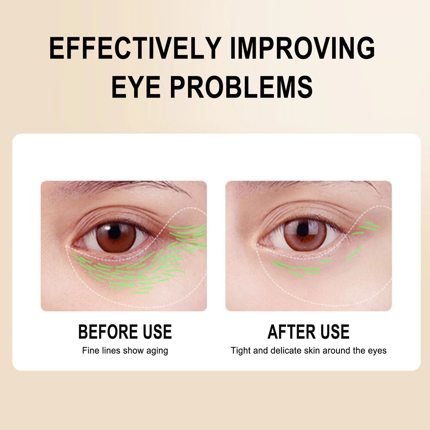 MAIGOOLE firming anti-wrinkle eye essential oil