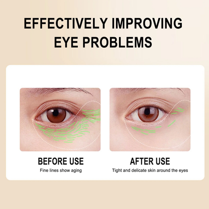 MAIGOOLE firming anti-wrinkle eye essential oil