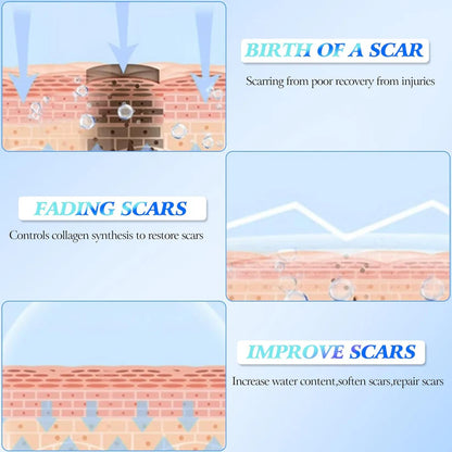 🔥Limited Time Offer🔥Skin Smoothing Scar Cream, Lighten & Repair All Scars
