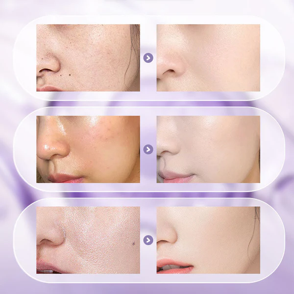 🎉2025 New Upgrade🎉All-in-One Niacinamide Cream