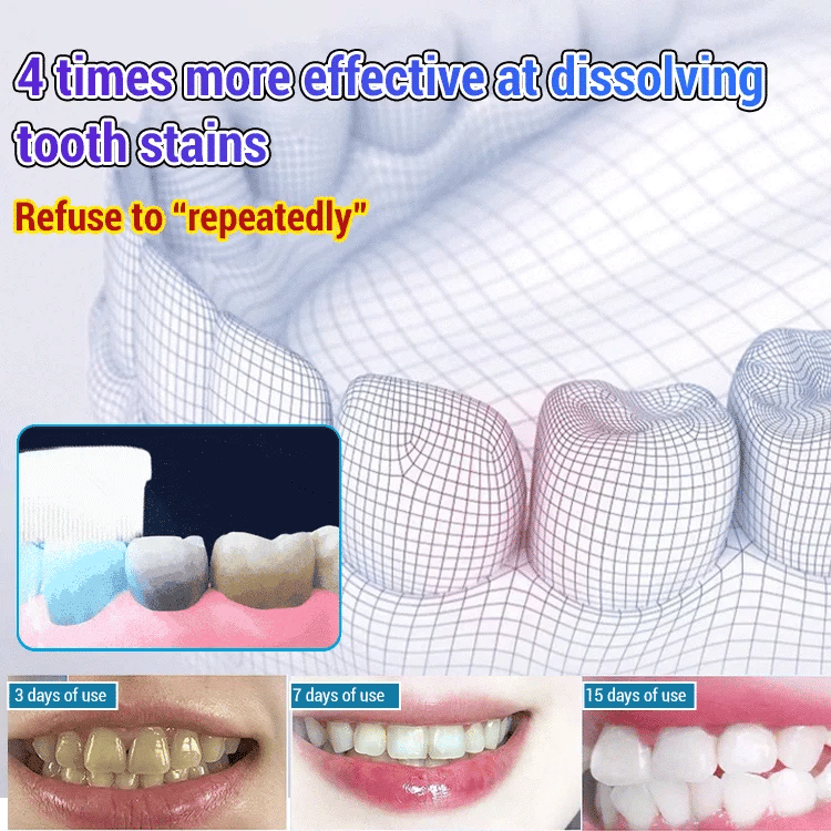 💥2024 Experts Recommend Product-Baking soda toothpaste oral care