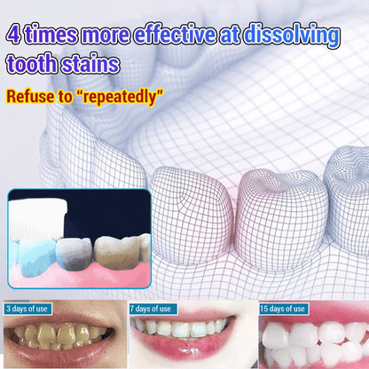 💥2024 Experts Recommend Product-Baking soda toothpaste oral care