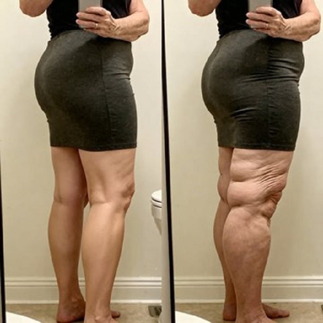 🔥Buy 2 Get 1 Free🔥🏆Limited time offer⚡ 50K+ SOLD! Almost Gone-💥Age-Defying Revival Collagen & Stem Cell Body Oil