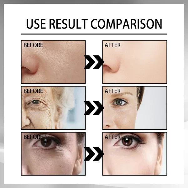 GREEVENER KOREAN SNAIL COLLAGEN LIFTING FIRMING CREAM