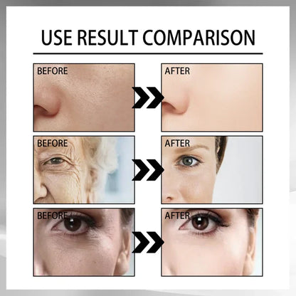 GREEVENER KOREAN SNAIL COLLAGEN LIFTING FIRMING CREAM