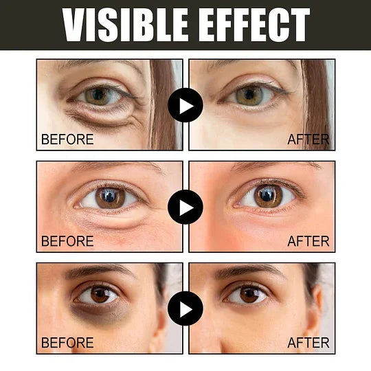 💥10000+ people feel effective🔥2024 NEW Retinol Caffeine Anti-Wrinkle Stay-Up Late Eye Cream