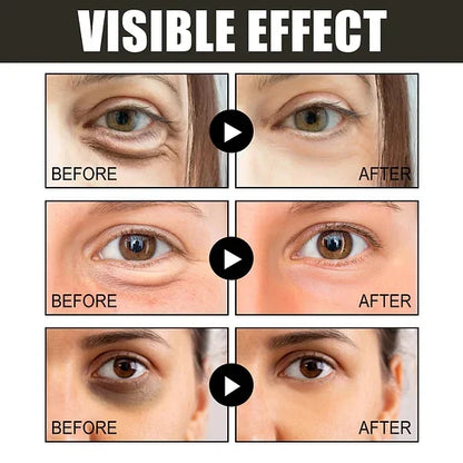 💥10000+ people feel effective🔥2024 NEW Retinol Caffeine Anti-Wrinkle Stay-Up Late Eye Cream